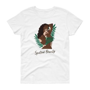 T-shirt Vitiligo Beauty T-shirt Vitiligo Beauty