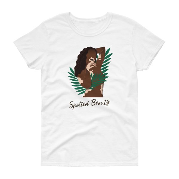 T-shirt Vitiligo Beauty